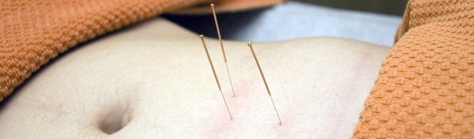 Accupuncture, Eastern Healing Arts in the Newtown, Bucks County PA area